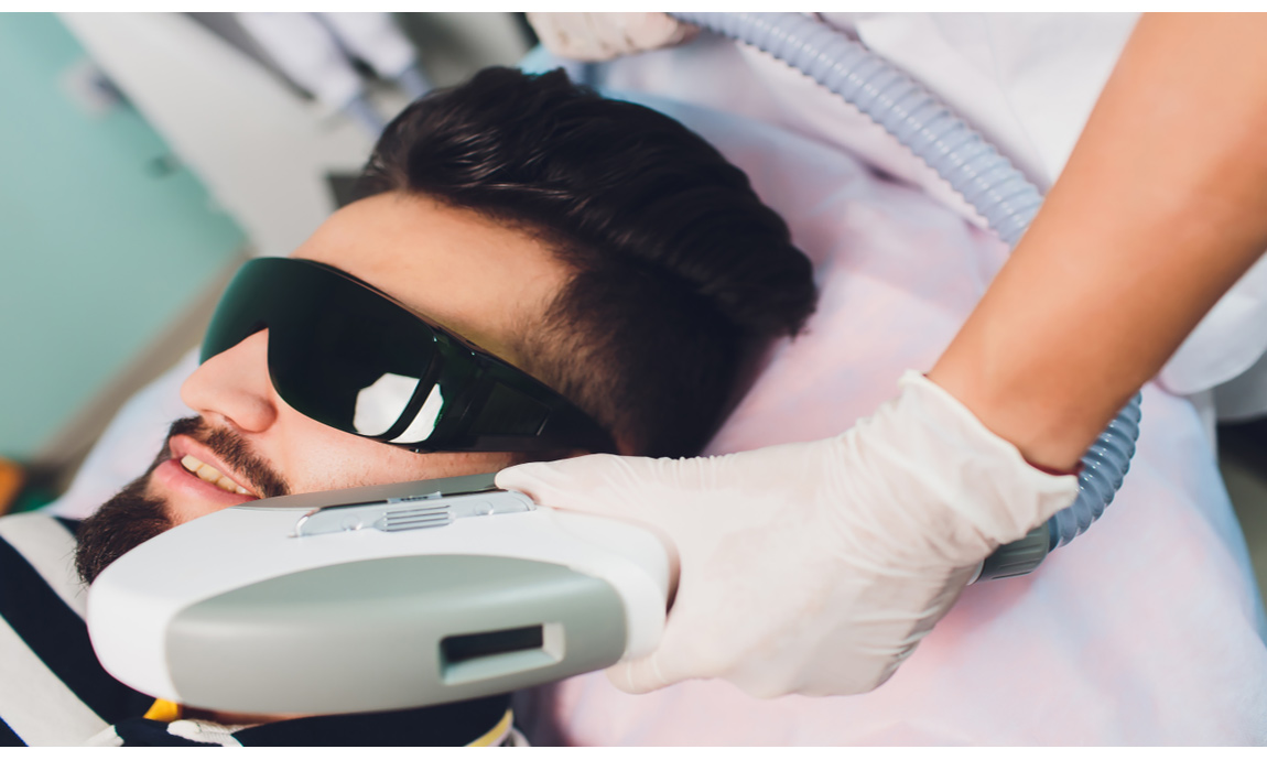 لیزر موهای زائد مردان