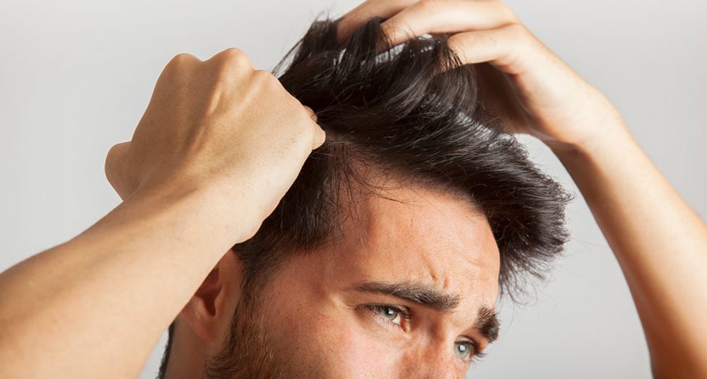 بهترین شامپو ضد شوره