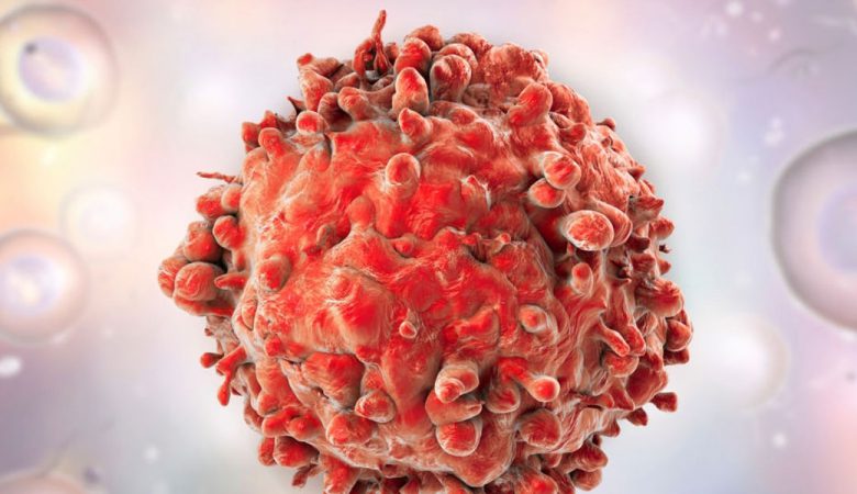 راه های جلوگیری از سرطان