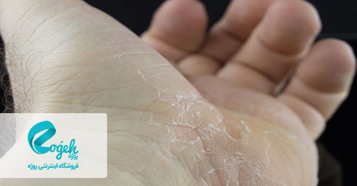 فواید آلوئه ورا برای پوست