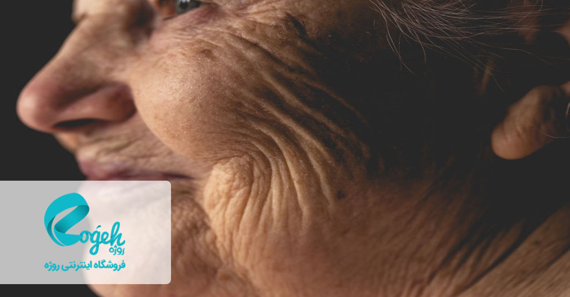 فواید آلوئه ورا برای پوست