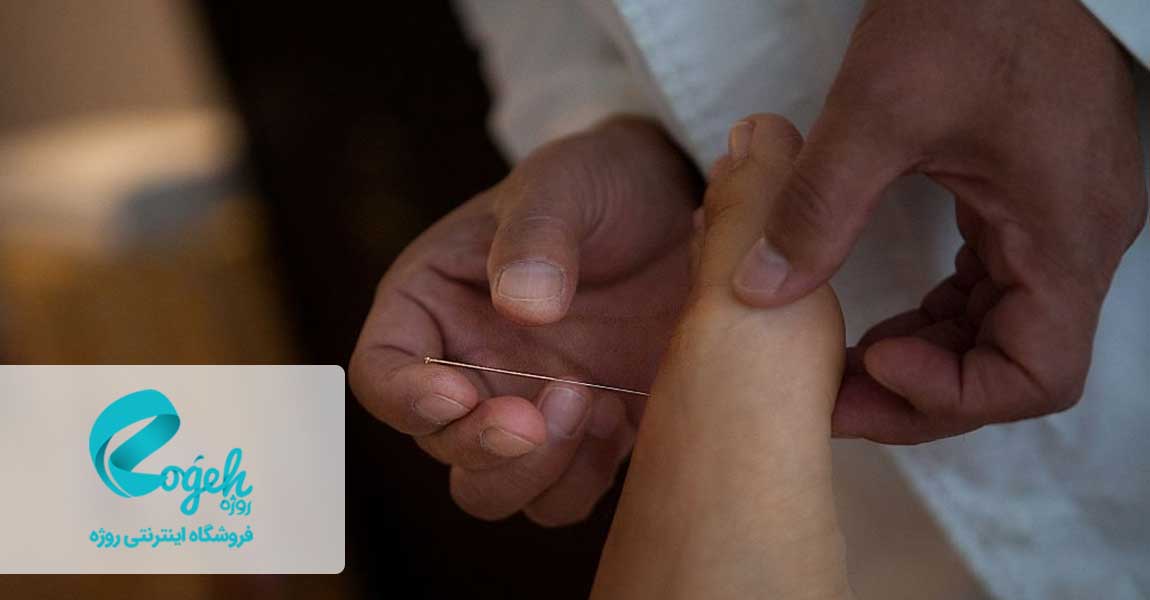 فواید طب سوزنی