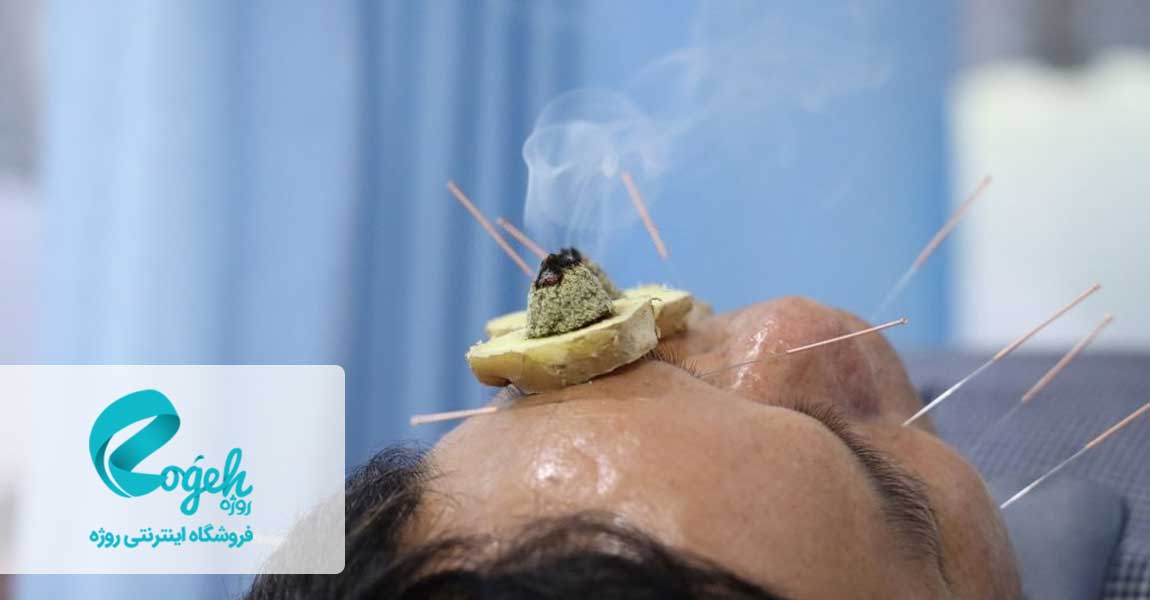 فواید طب سوزنی