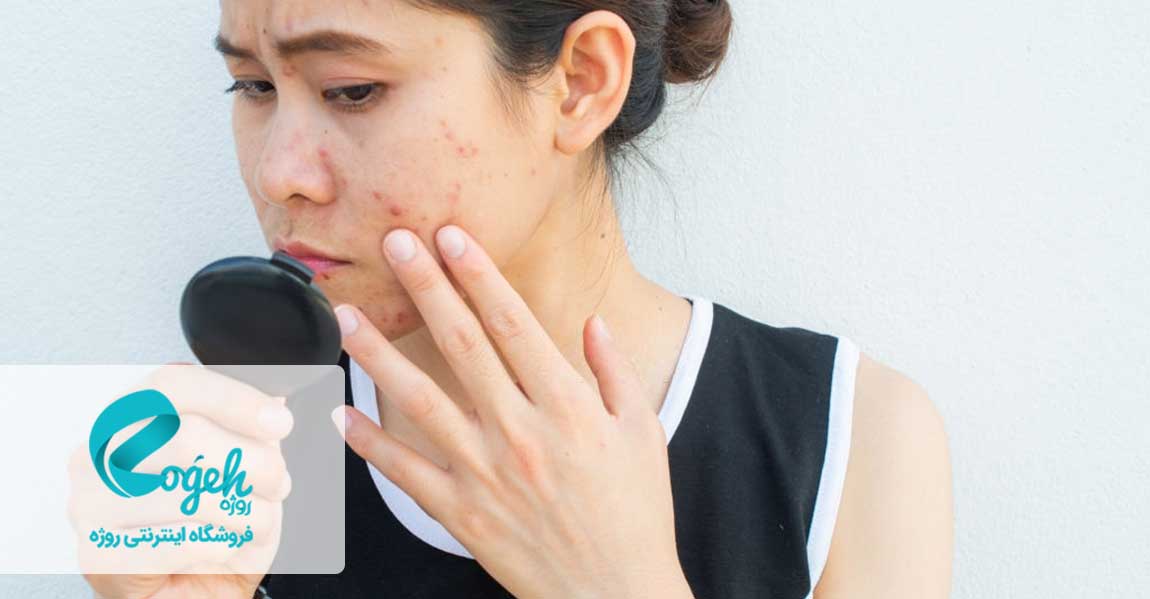 عوارض مصرف زیاد لبنیات