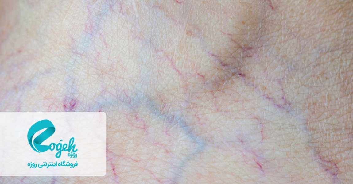 تشخیص تناژ پوست