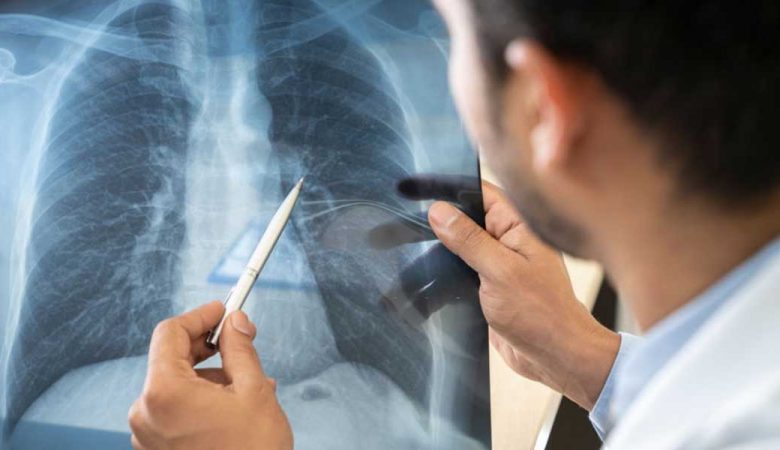 سلامت ریه ها