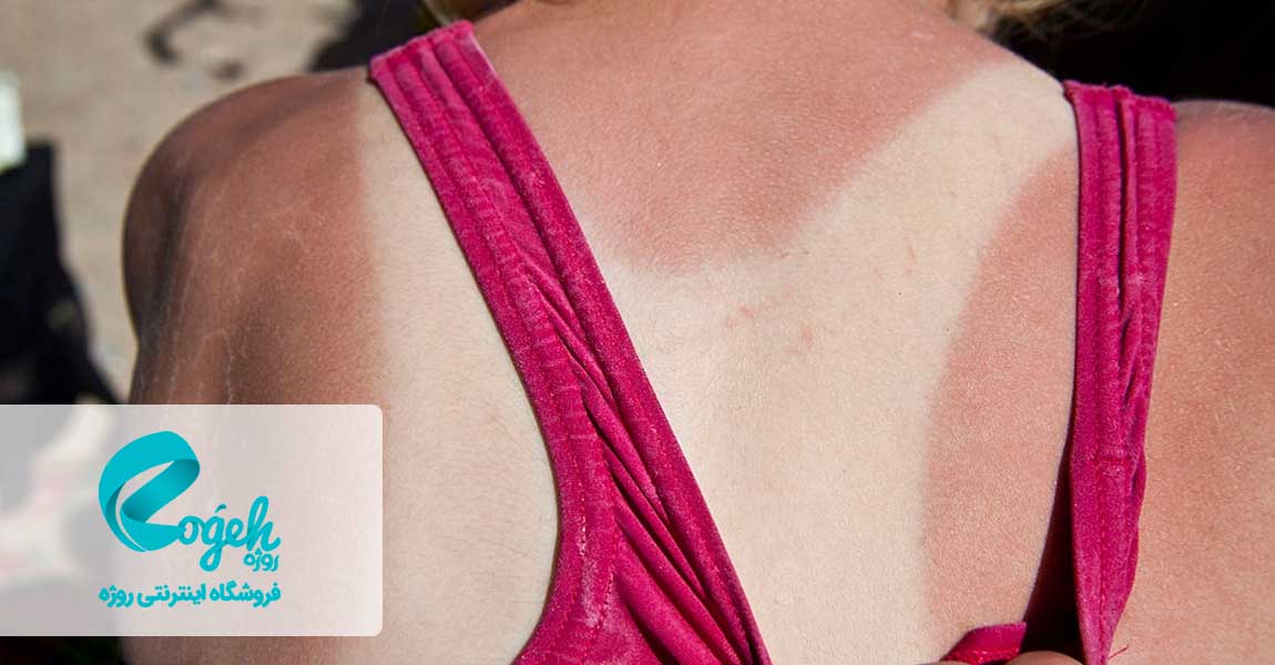 تشخیص تناژ پوست