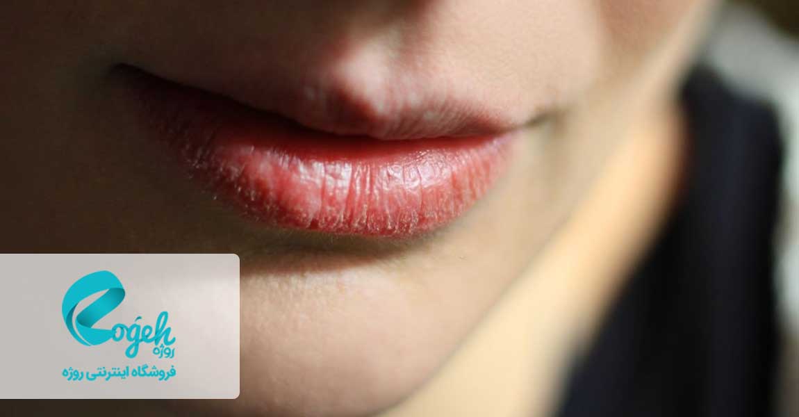 عوارض راکوتان