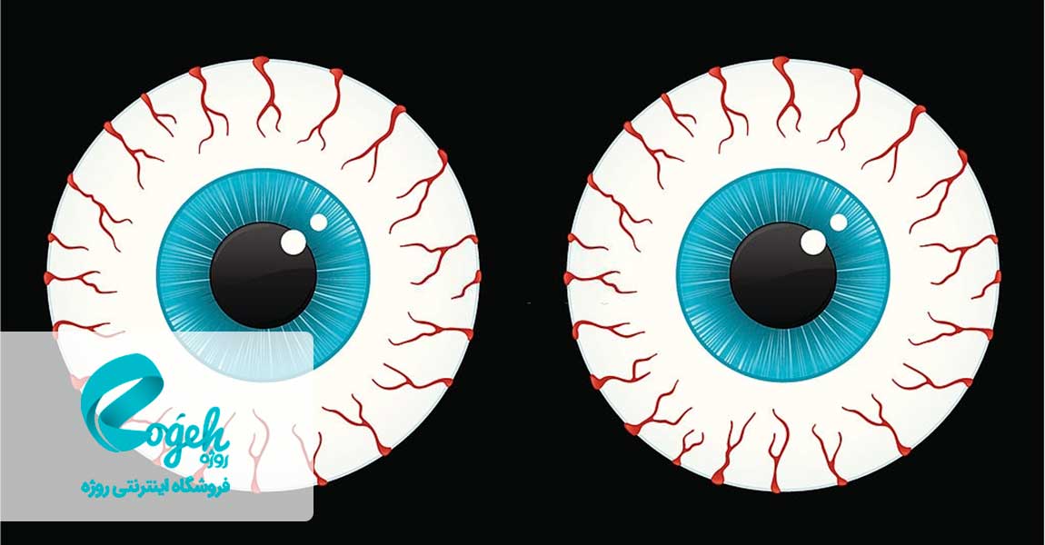 رفع خستگی چشم