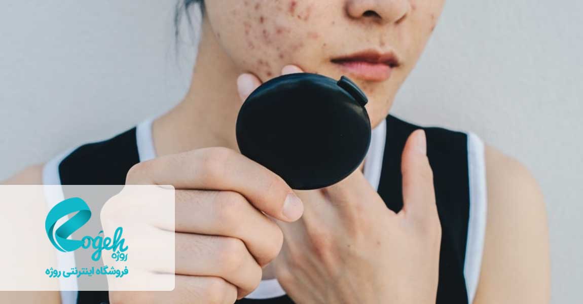 عوارض راکوتان