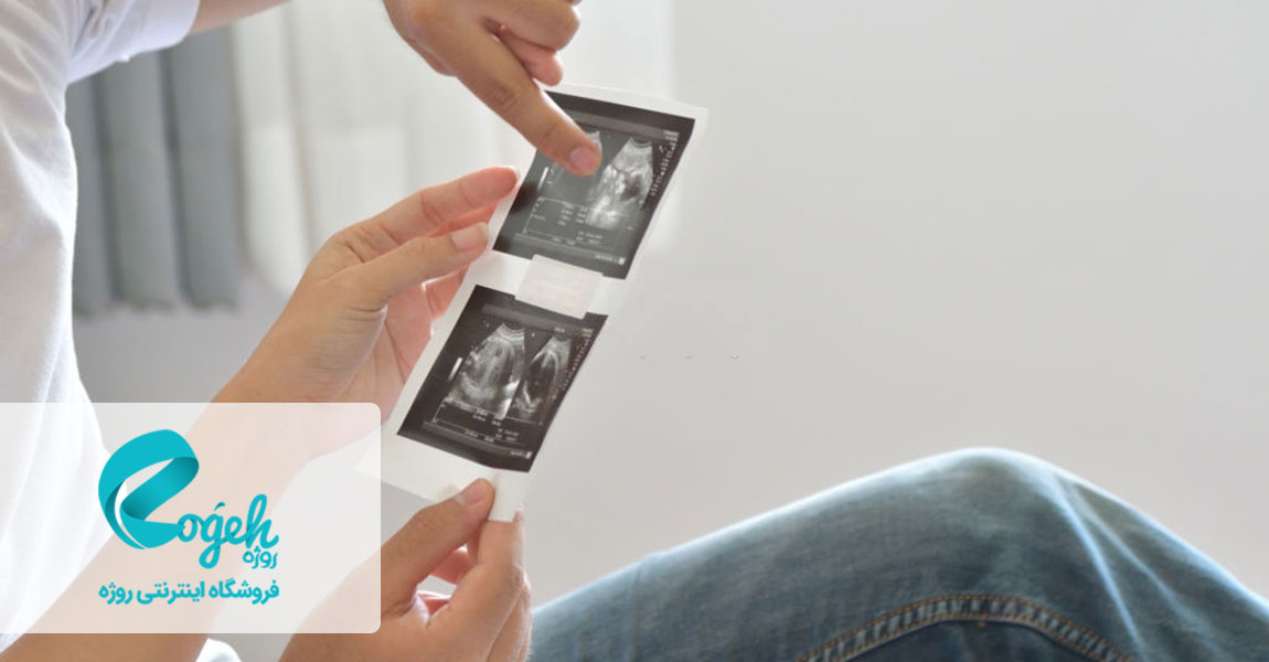 بارداری خارج از رحم