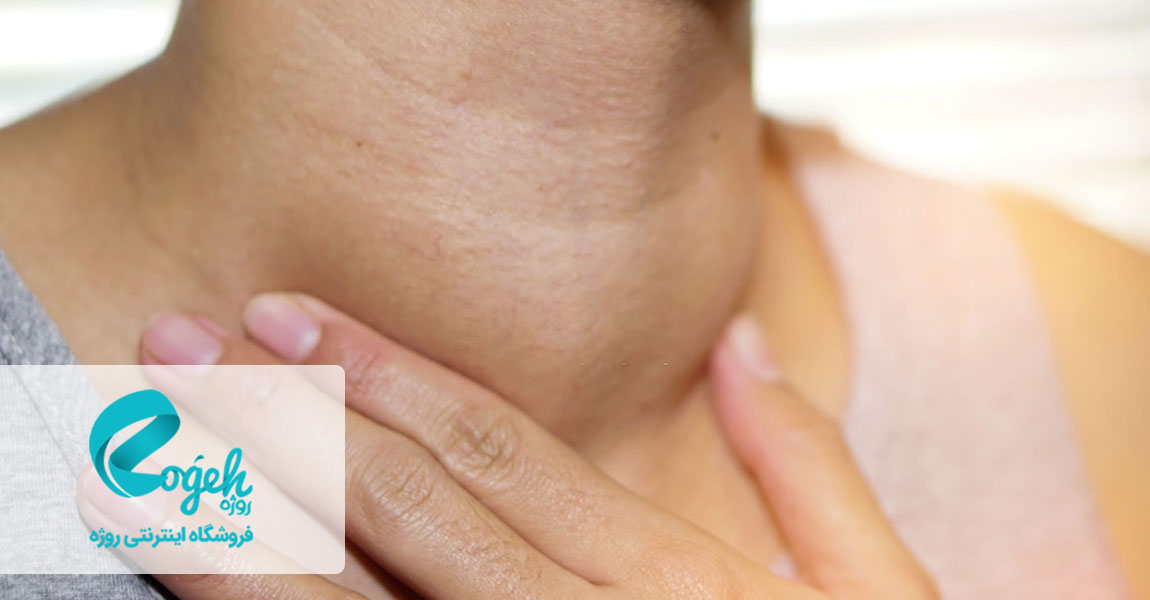 علائم گواتر