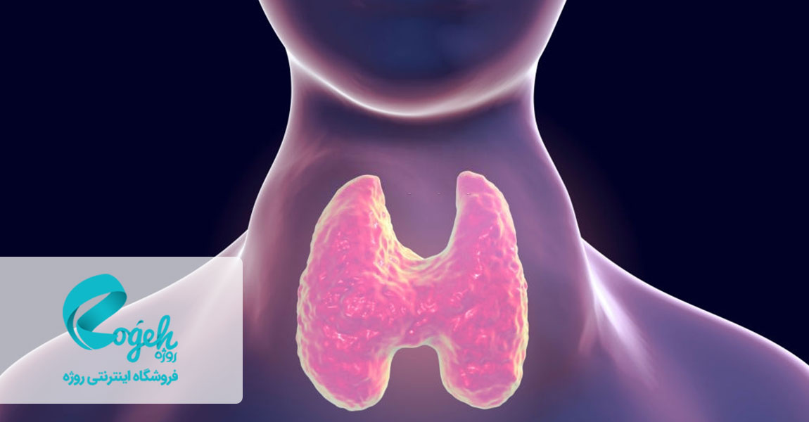 علائم گواتر