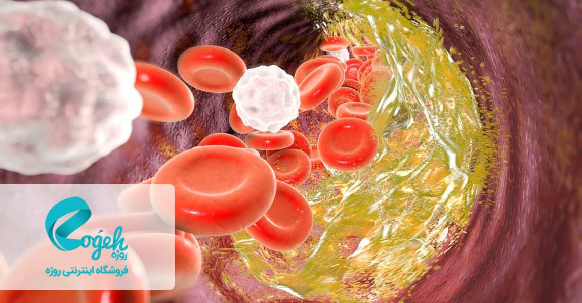 کاهش کلسترول خون