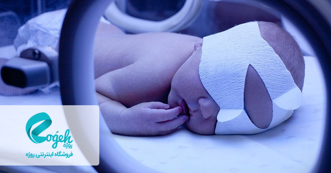 زردی نوزادان