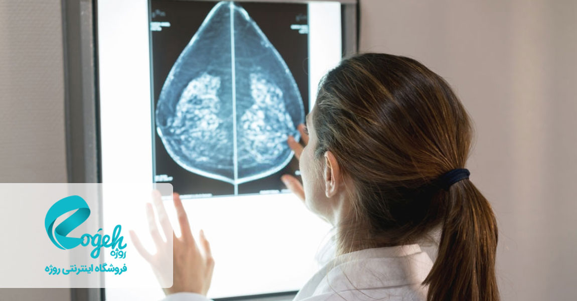 شایع ترین سرطان ها