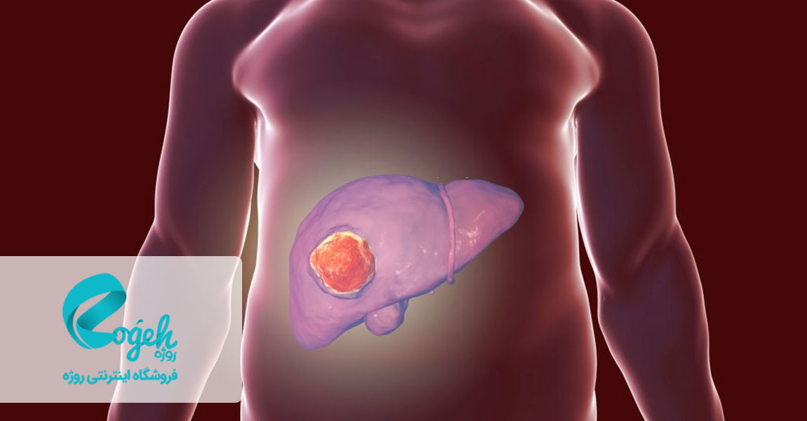 سرطان کبد