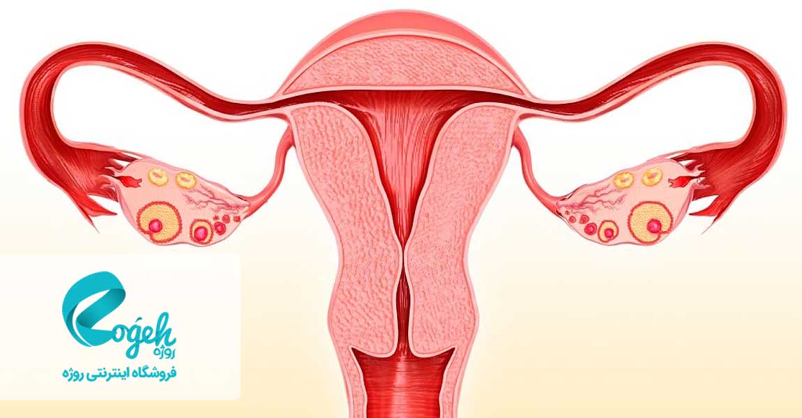 درمان رحم دوشاخه