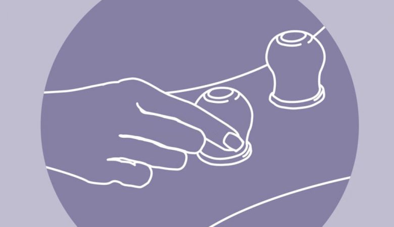 فواید حجامت