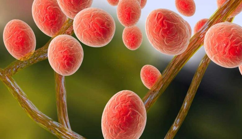 درمان قارچ پوستی