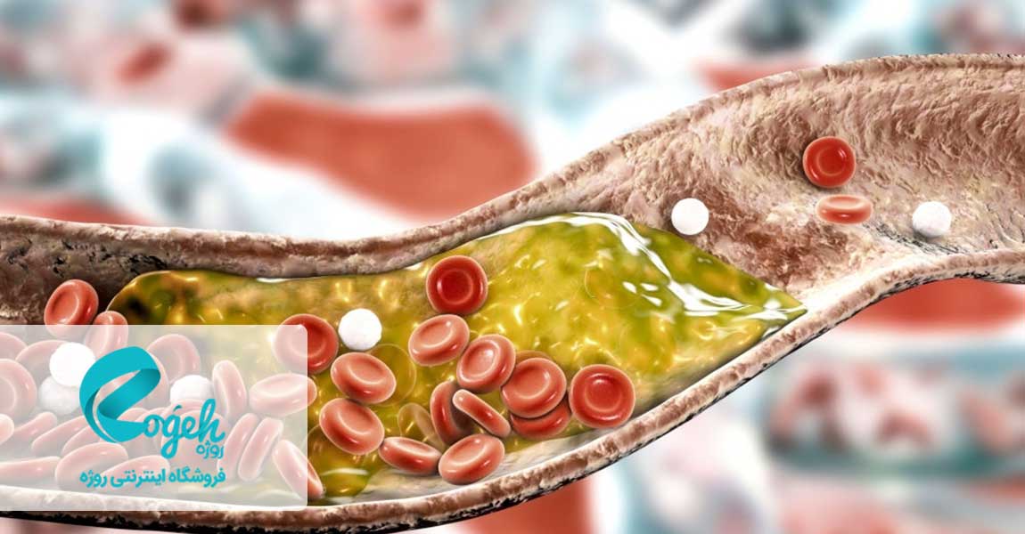 کلسترول خون