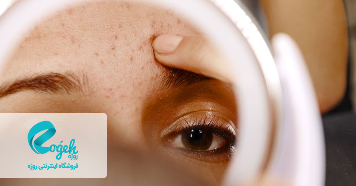 پماد زینک اکساید