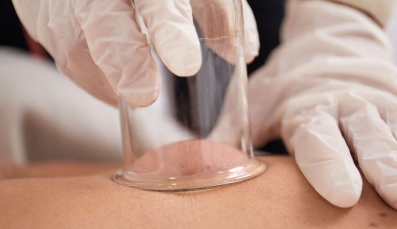 فواید بادکش