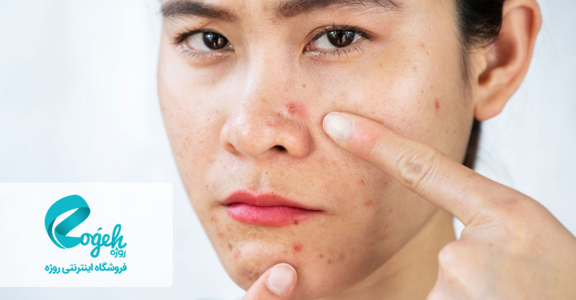 درمان التهاب پوست