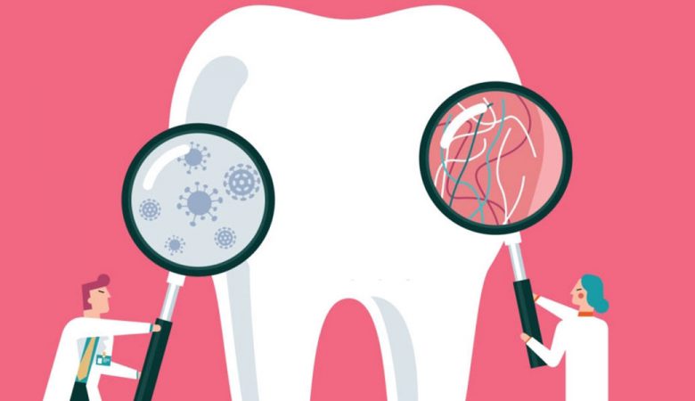 درمان آبسه دندان