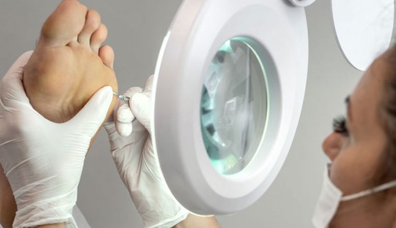 درمان پینه پا