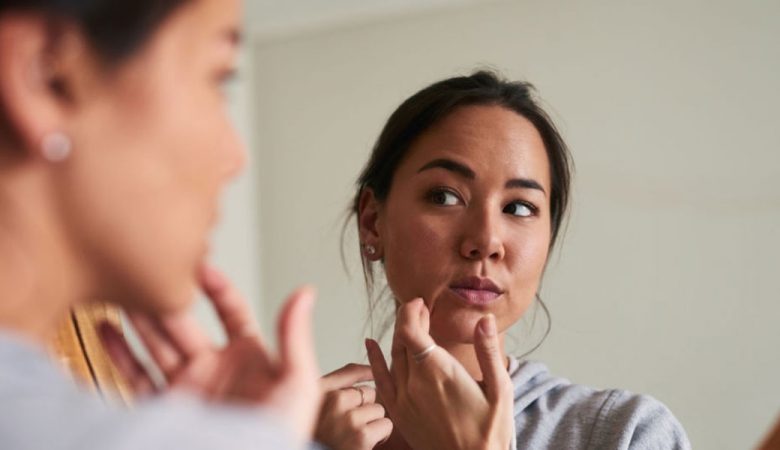 درمان لوپوس