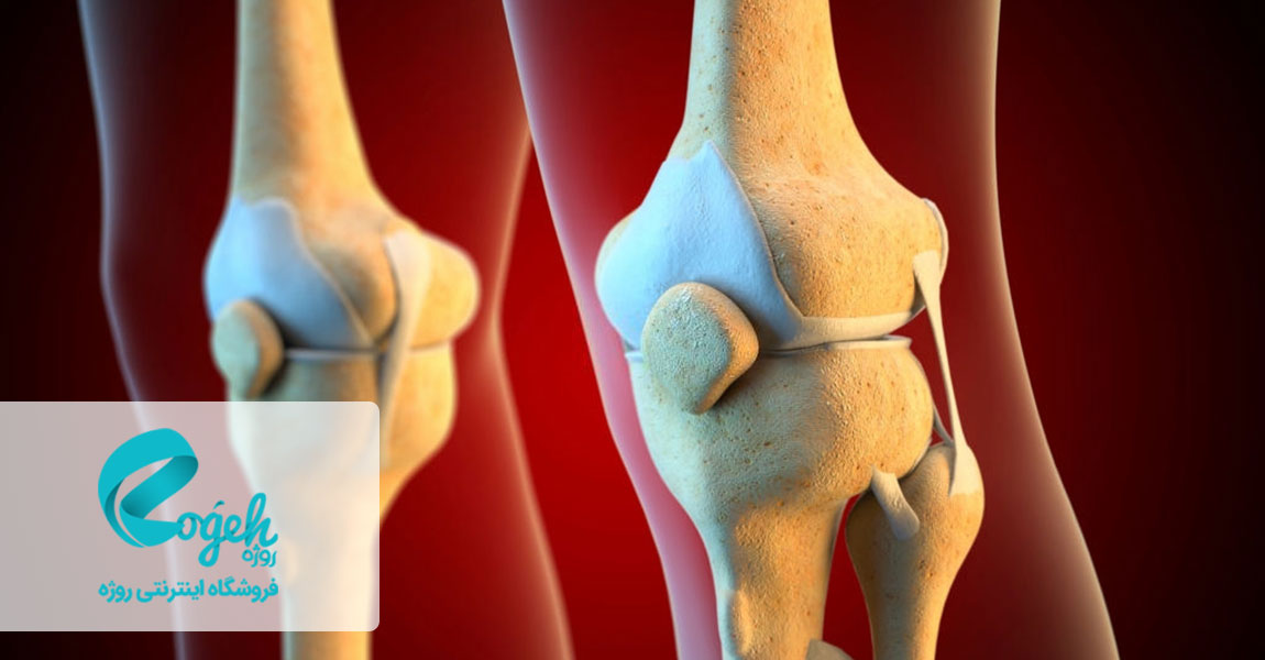 پارگی رباط زانو