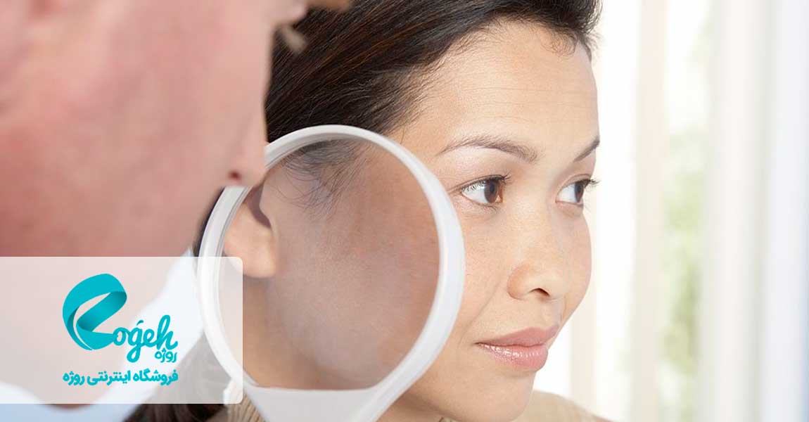 درمان واریس صورت