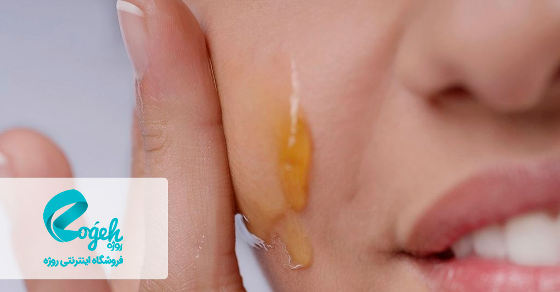 درمان میلیا