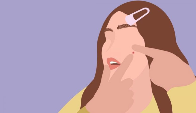 رژیم غذایی ضد جوش