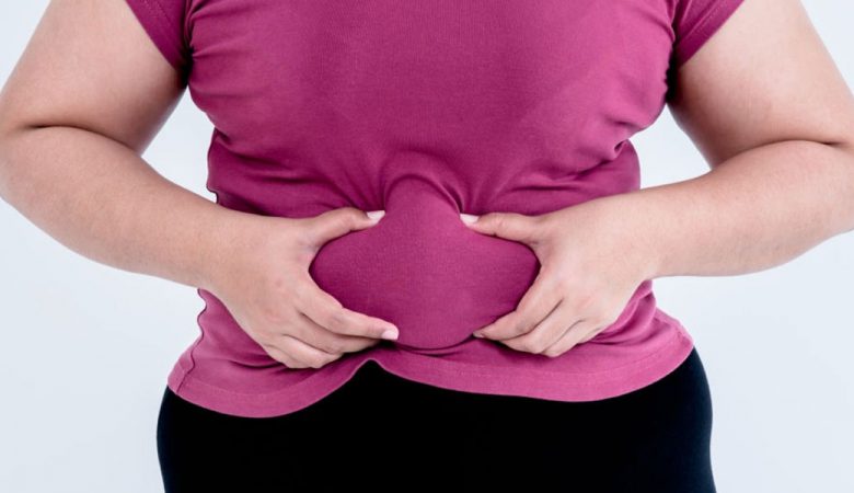 جراحی ابدومینوپلاستی