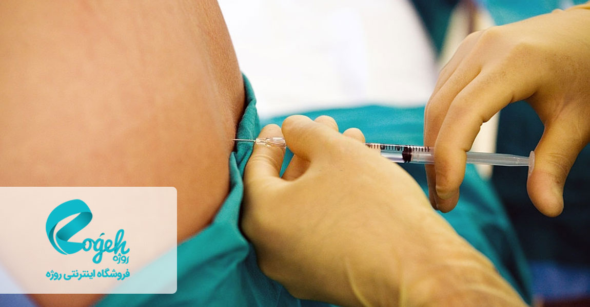 بی حسی اپیدورال