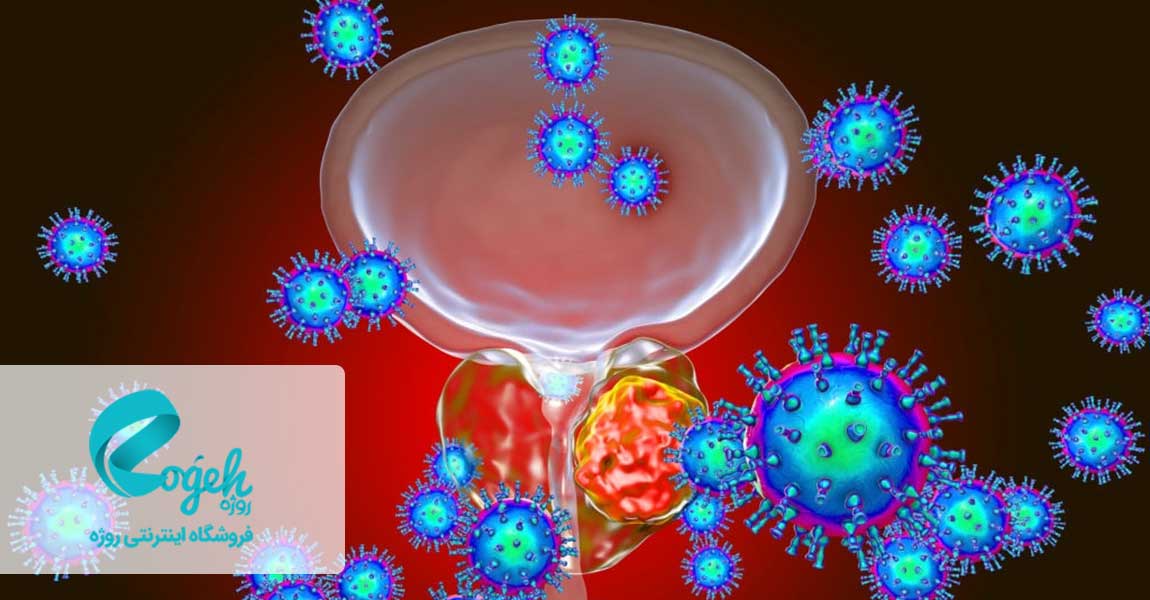 سرطان پروستات