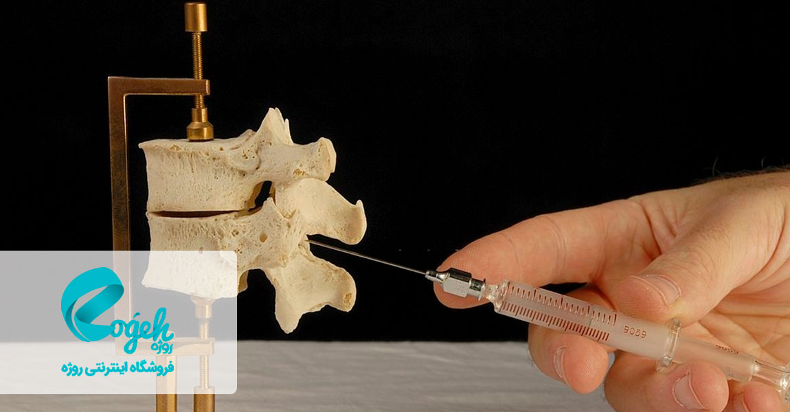 بی حسی اپیدورال