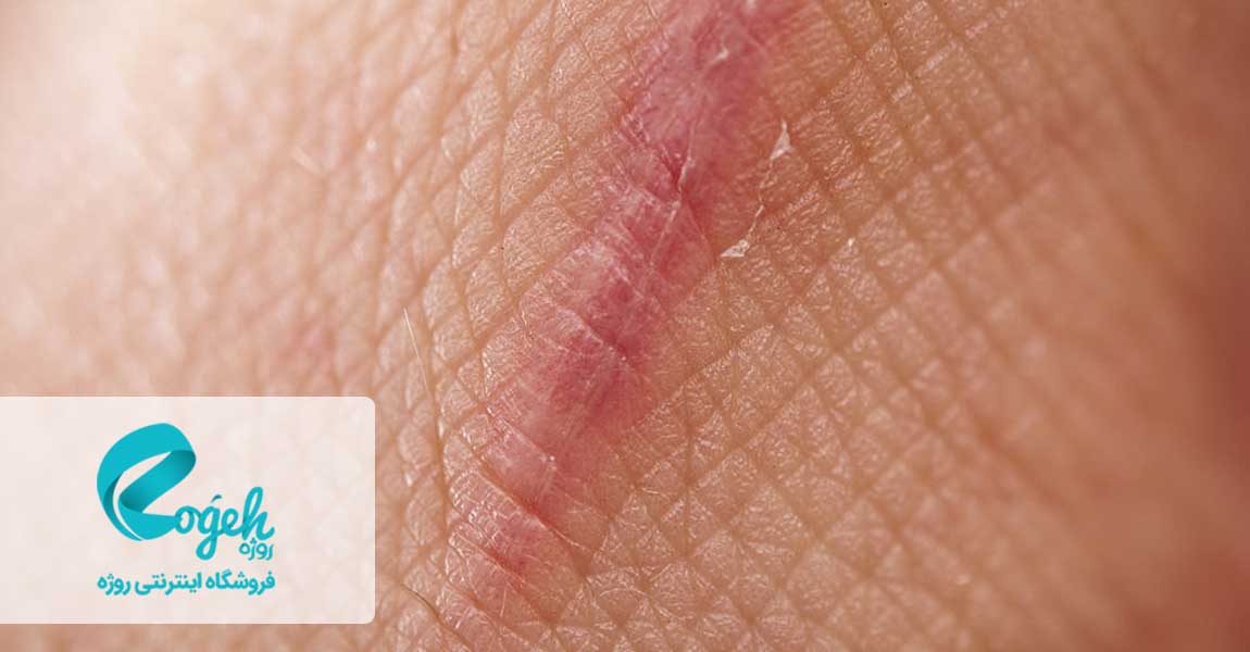 خواص ویتامین ای