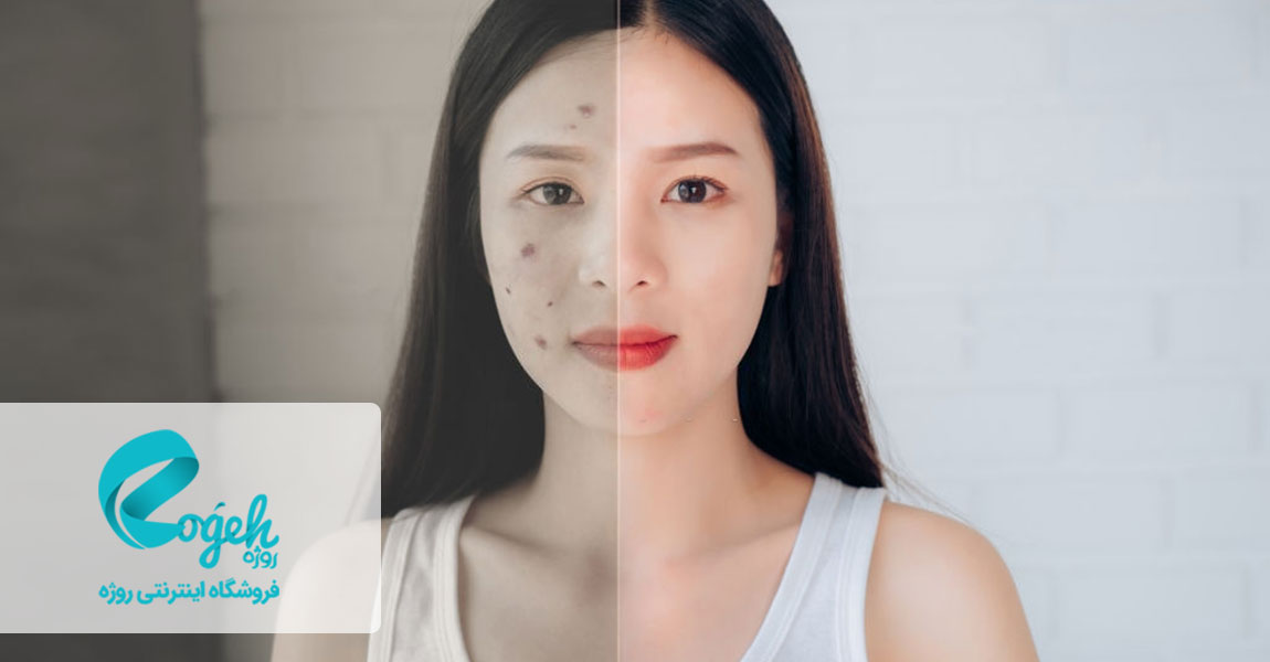 خواص خاکشیر