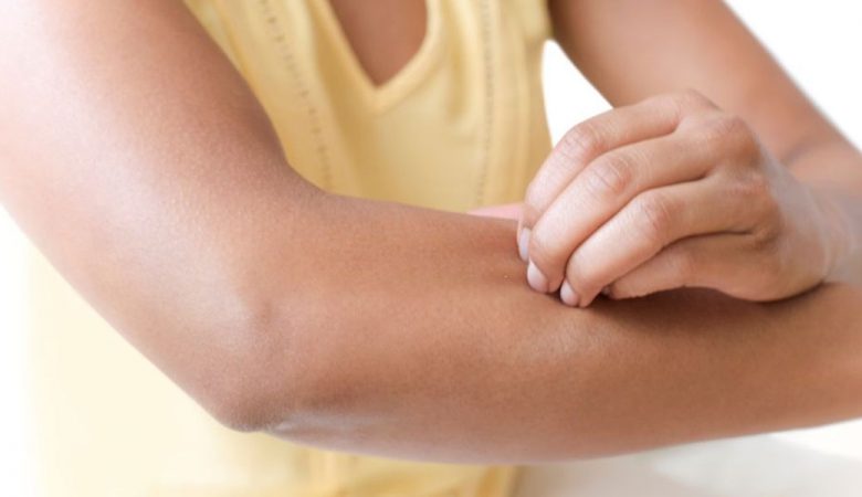 جلوگیری از نیش زدن حشرات