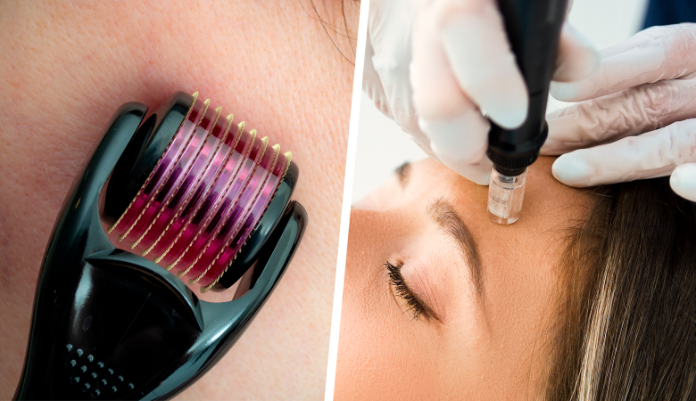 فواید معجزه آسای میکرونیدلینگ در زیبایی و جوانسازی - روژه