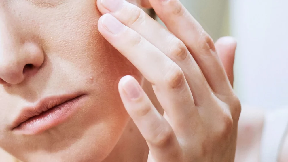 درماتیت صورت چیست و چگونه درمان می شود؟ - روژه مگ