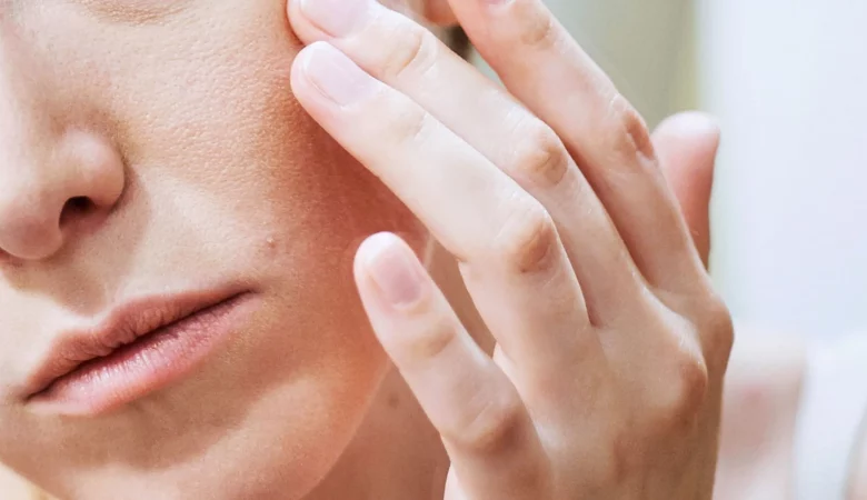 درماتیت صورت چیست و چگونه درمان می شود؟ - روژه مگ