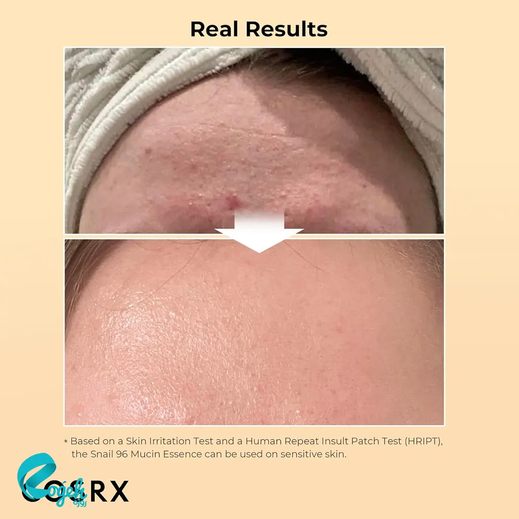 اسنس حلزون کوزارکس COSRX Advanced Snail 96 Mucin Power Essence – آبرسانی و ترمیم پوست با ۹۶٪ موسین حلزون