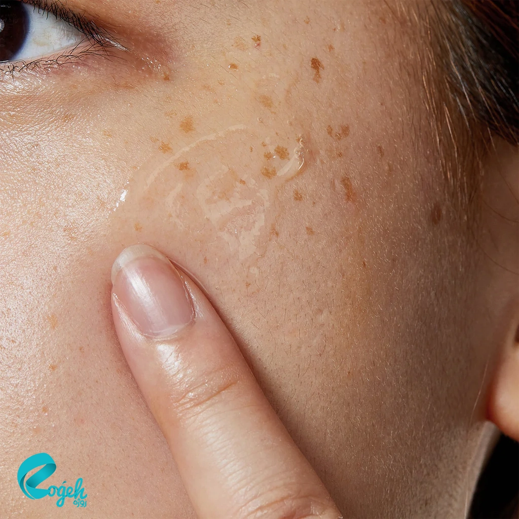 سرم آبرسان ۳٪ هیالورونیک اسید کوزارکس