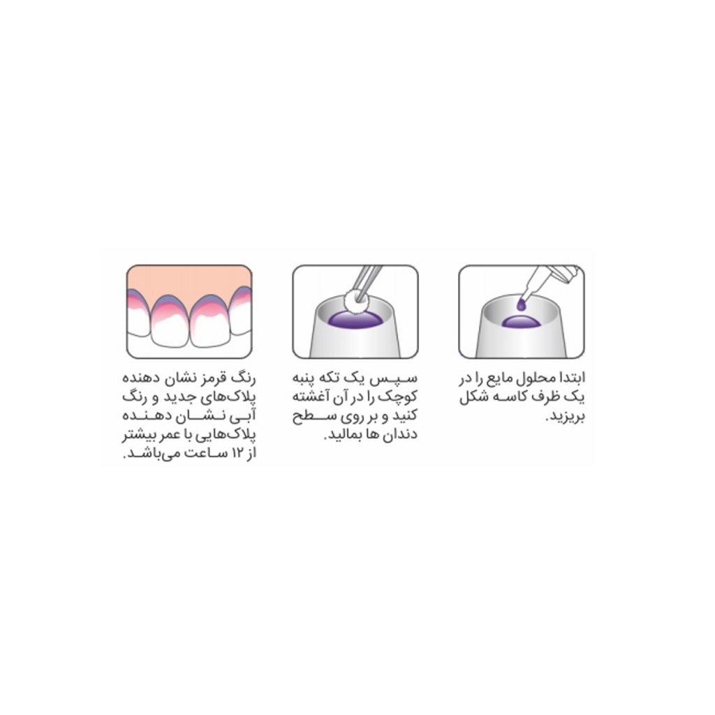 محلول شناسایی جرم دندان تپه